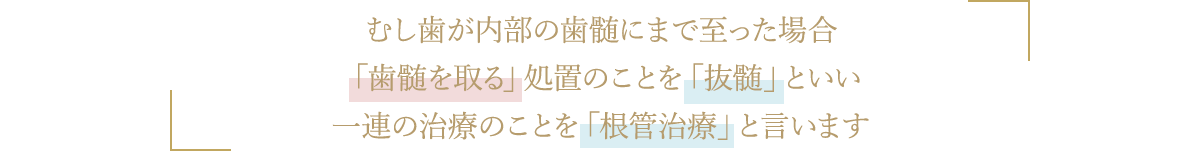 むし歯が内部の歯髄にまで至った場合「歯髄を取る」処置のことを「抜髄」といい一連の治療のことを「根管治療」と言います。