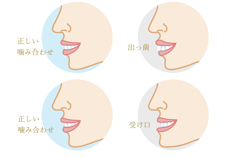 骨格のバランスを考える