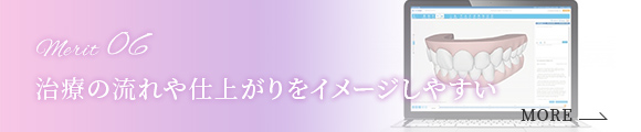 Merit 06 治療の流れや仕上がりをイメージしやすい