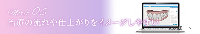 Merit 06 治療の流れや仕上がりをイメージしやすい